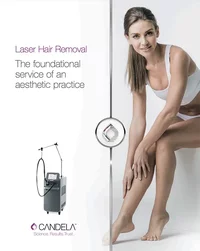 laser hair removal