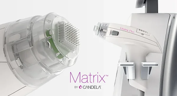 Matrix by Candela