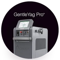 GentleYag Pro laser machine