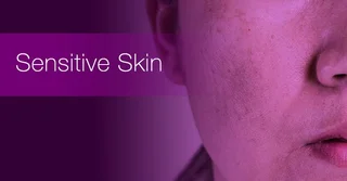 Sensitive Skin