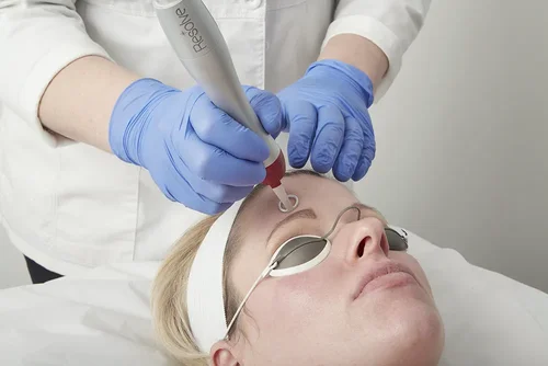 PicoWay laser for pigmented lesions
