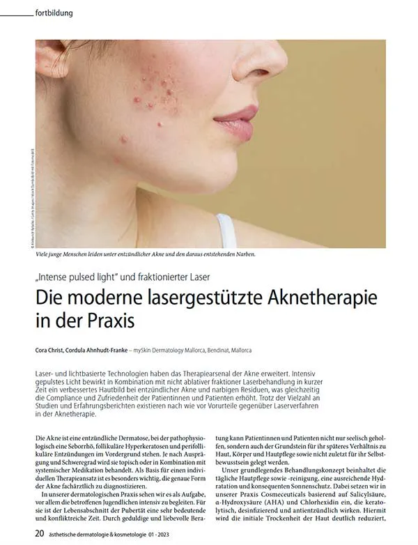 Intense pulsed light und fraktionierter Laser