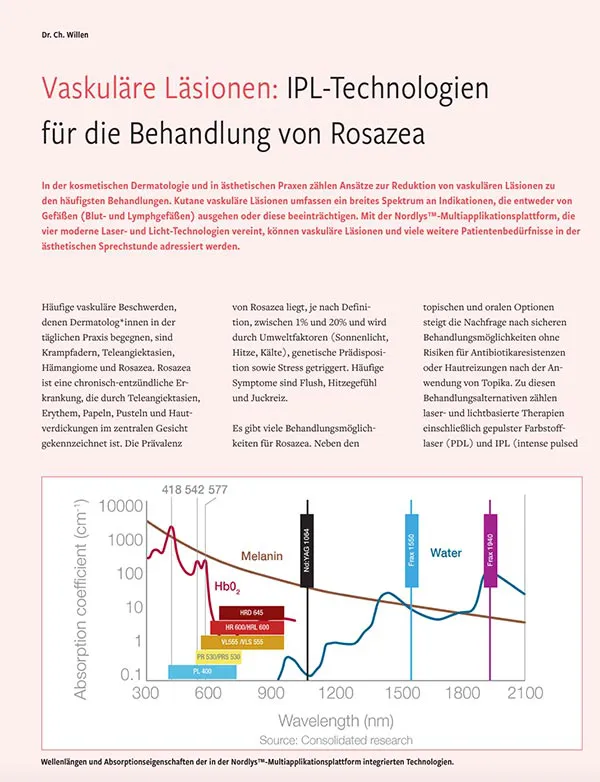 IPL Technologien fur die Behandlung von Rosazea