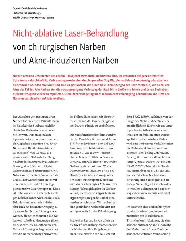 Nicht-ablative Laser-Behandlung