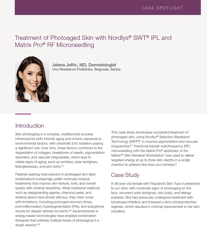 Treatment of Photoaging skin with Matrix and Nordlys