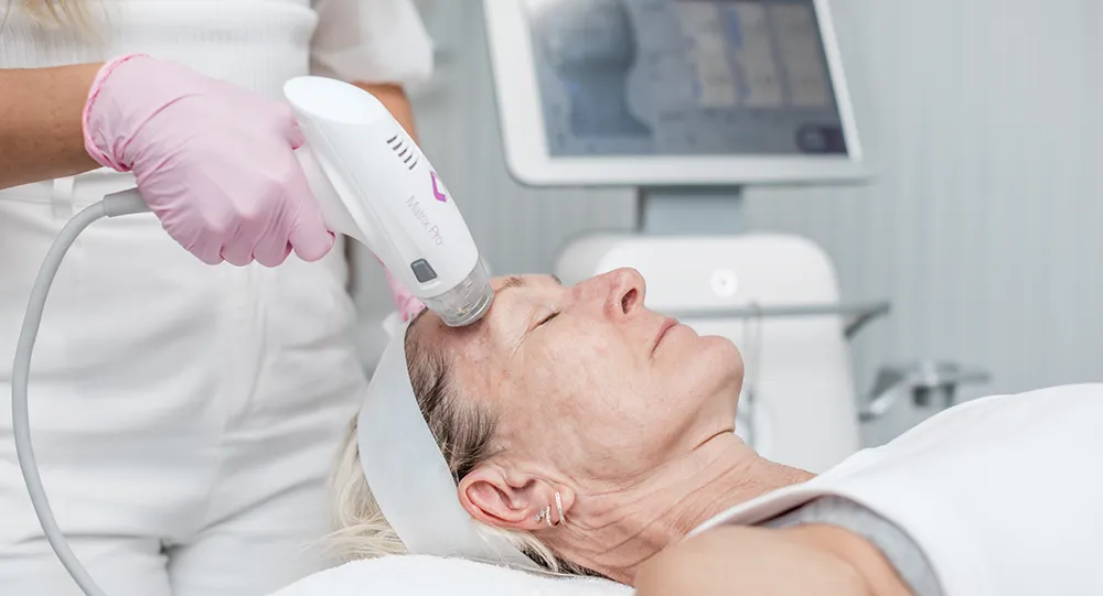 RF Microneedling