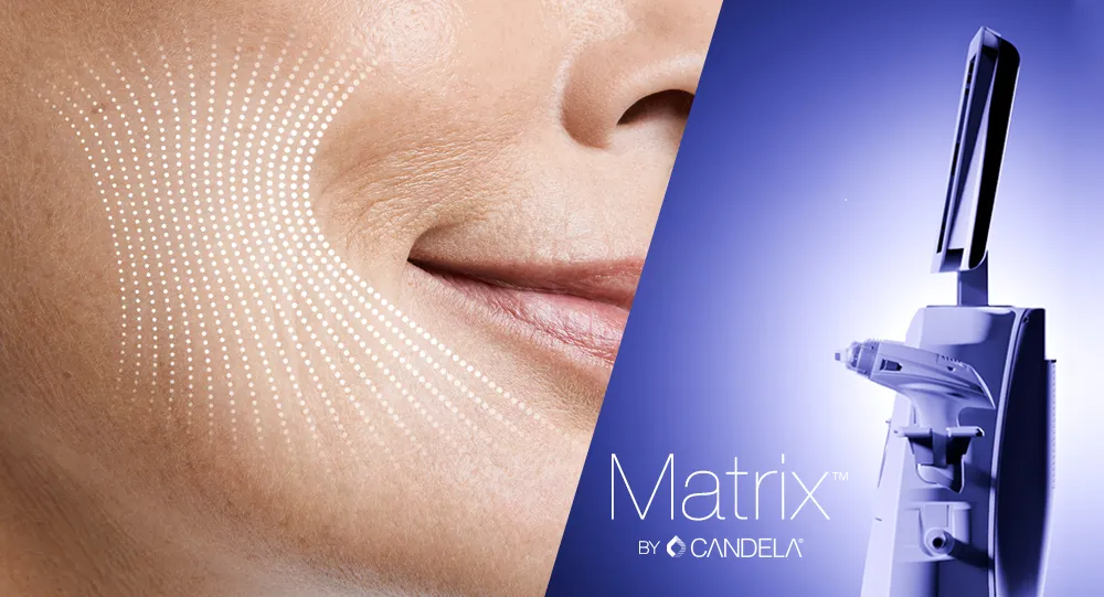 Skin depth impacts RF treatment results