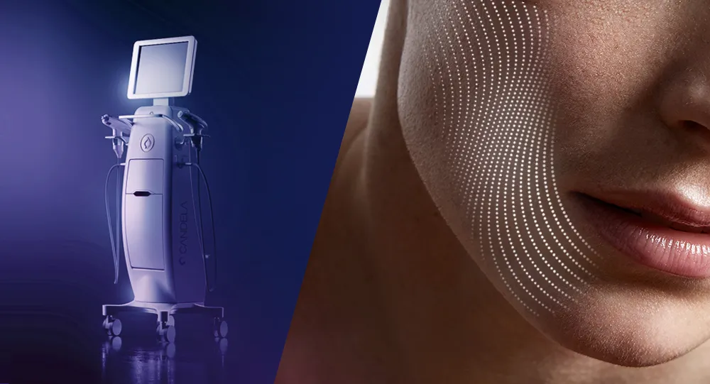 Matrix RF treatment solutions for skin concerns