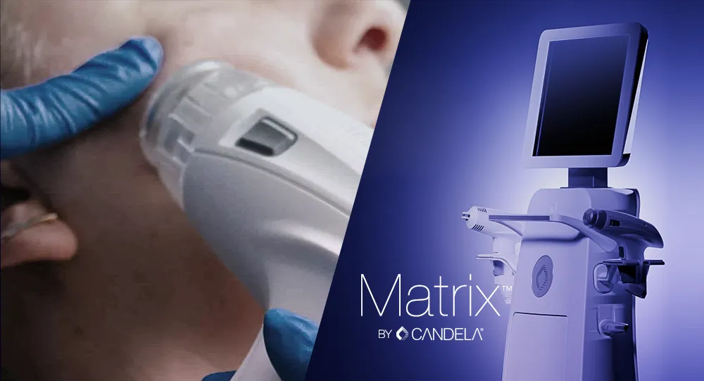 Matrix smarter skin renewal for smarter preactices